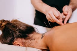 Fysiotherapeut past dry needling toe op de bovenrug van een patiënt