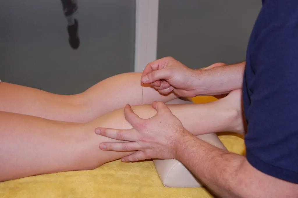 Dry Needling